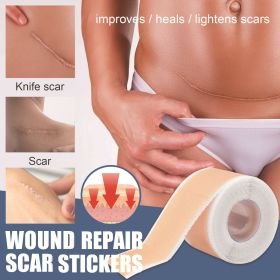Silica Gel Scar Repairing Stickers (Option: 4X150CM-Silica Gel Scar Paster)